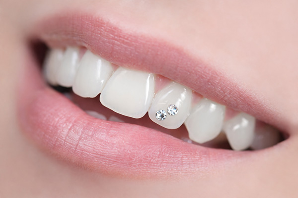 ティースジュエリー